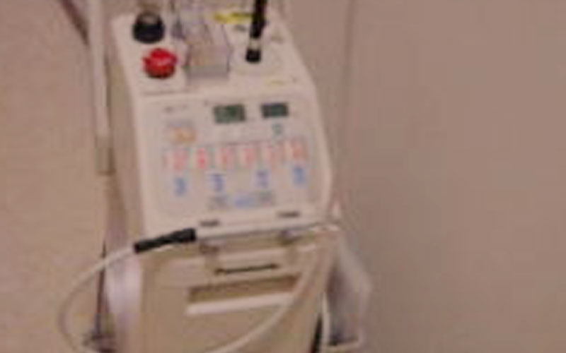 炭酸ガスレーザー