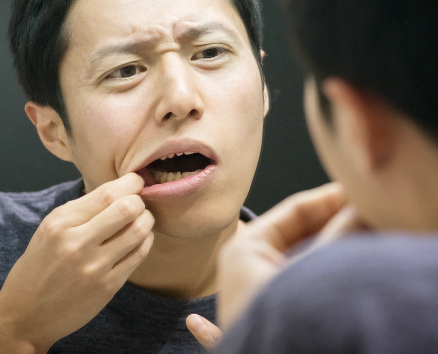 歯茎のはれ出血