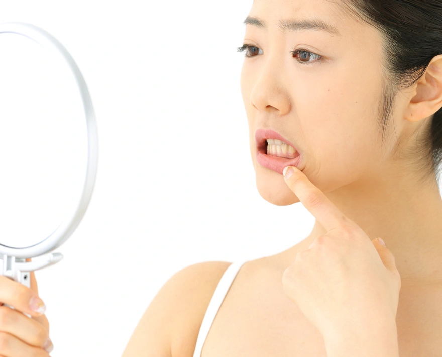 歯のくすみ黄ばみ