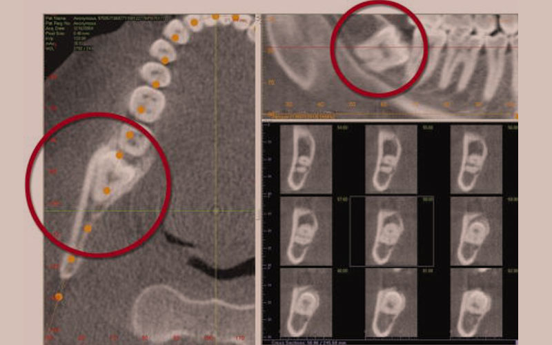 スーパー・パノラマ