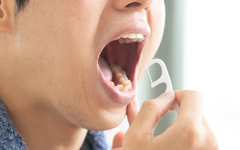 歯周病治療では原因菌を減らす対策も重要