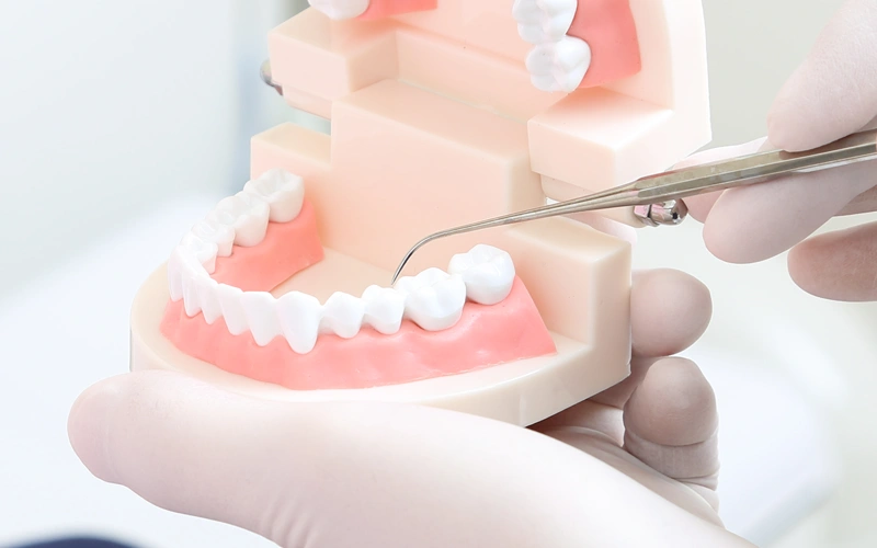 歯肉退縮の治療について