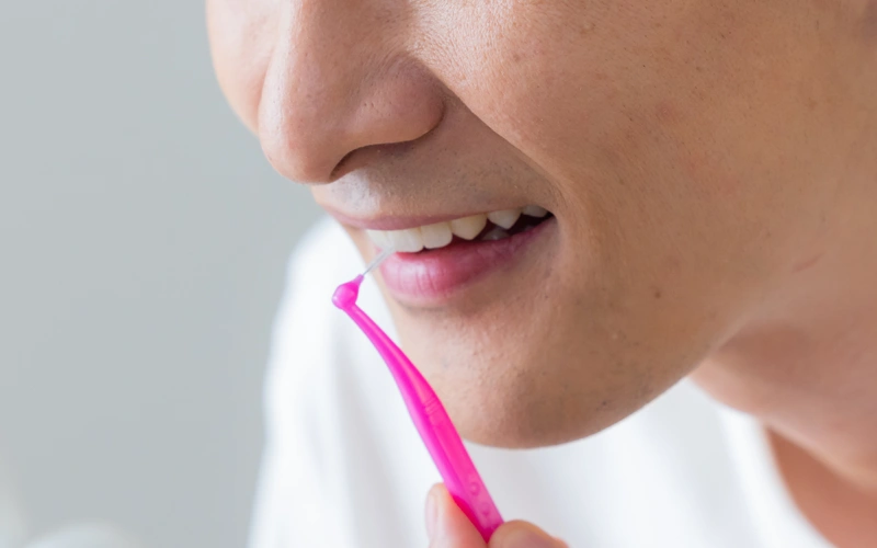 ホワイトスポットの治療